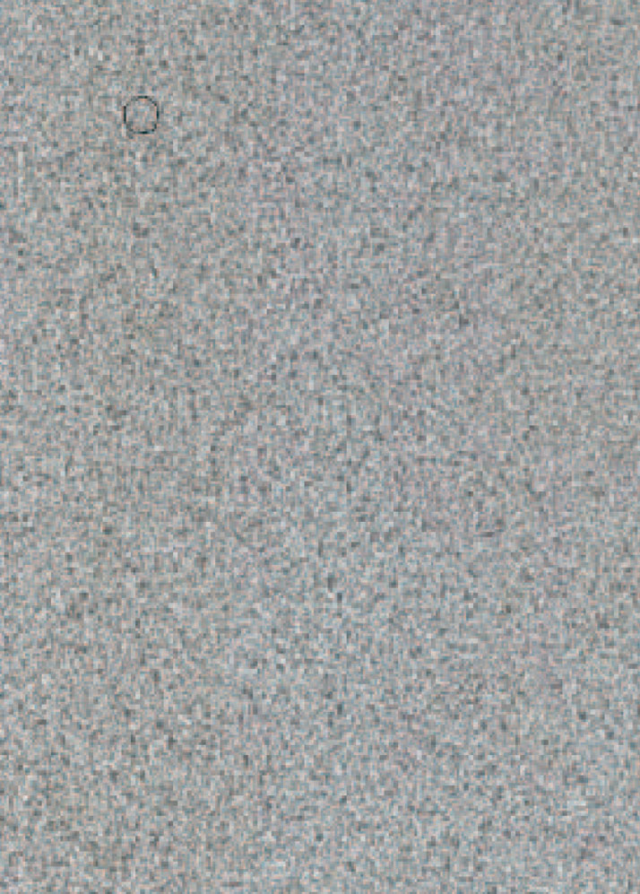 Pattern 4